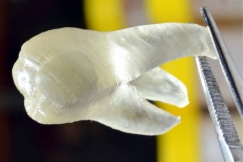 This 3D printed dental prosthetic could help fight bacteria. Courtesy of  J. Yue, P. Zhao, J. Y. Gerasimov et al.