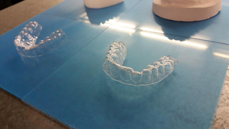 A pair of Dudley's DIY orthodontic aligners. Courtesy of amosdudley.com. 