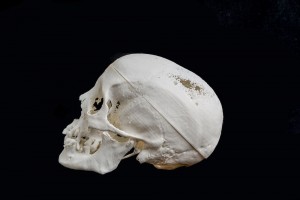 3d-printed-skull